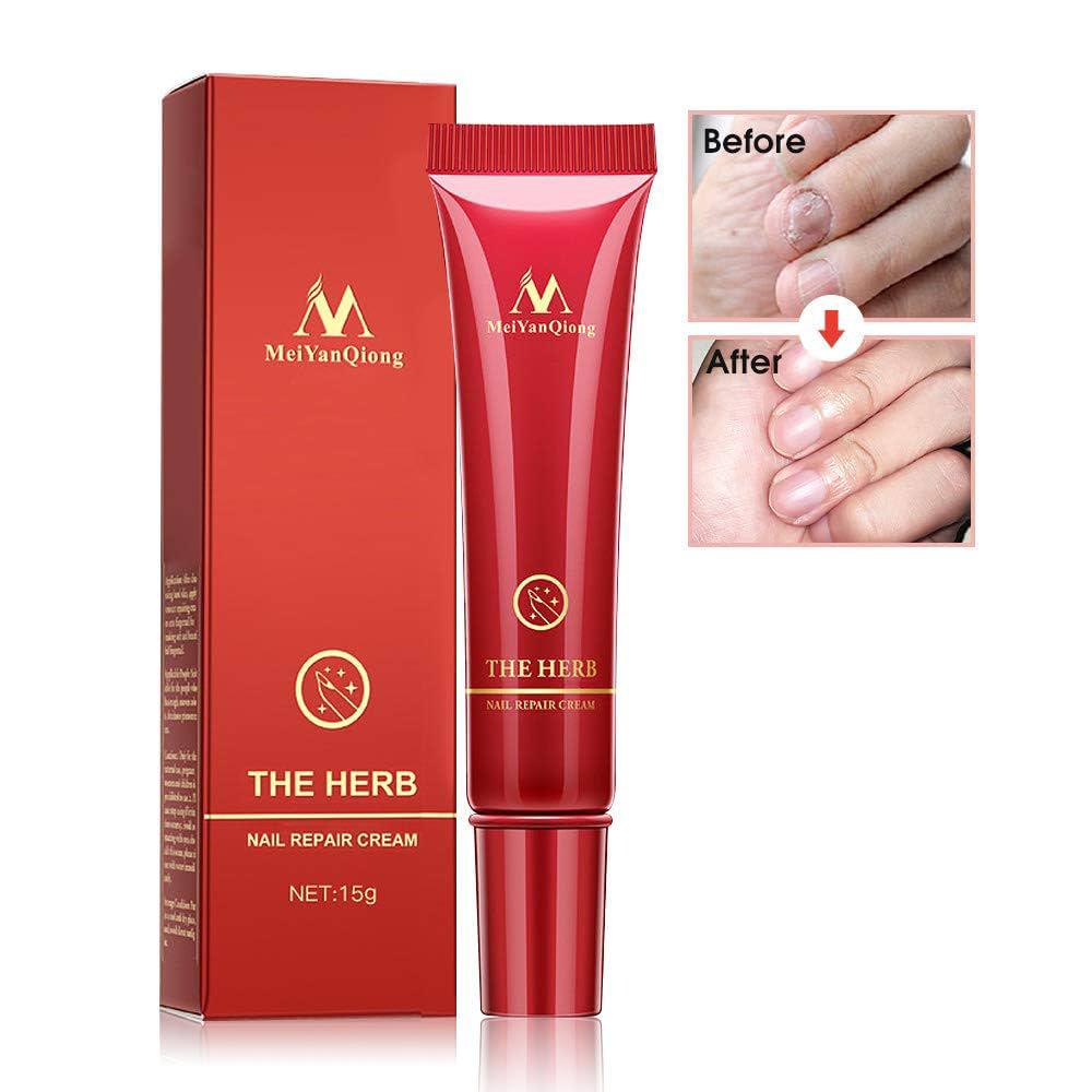 Retrouvez la Beauté Naturelle et l'Éclat de Vos Ongles